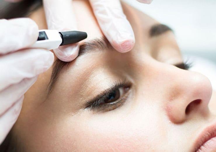 Depilación Eléctrica